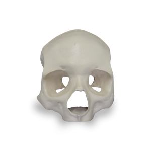 CRÂNIO  FRONTAL All-on-4® HIBRIDO - cód. 9013