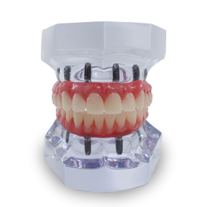 KIT DE PROTOCOLOS SUPERIOR E INFERIOR - cód. 11988