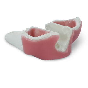 MAXILA ATRÓFICA COM GENGIVA PARA TREINAMENTOS – cód. 14576