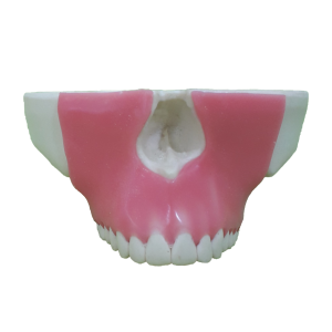 MAXILA COM TODOS OS DENTES E GENGIVA - cód. 4016G