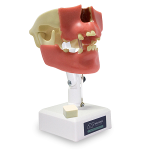MANEQUIM PRÉ-MOLAR COM GENGIVA - cód. 4005 G