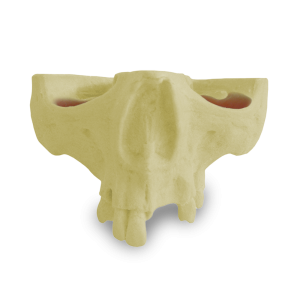 MAXILA COM ALGUNS DENTES - DENTES  11, 12, 14, 18, 24, 26 e 27 - cód. 4015 T