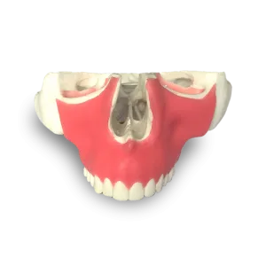 MAXILA COM TODOS OS DENTES E GENGIVA - cód. 4016GT