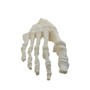 PÉ TORTO CONGÊNITO - DIREITO - cód. 8868